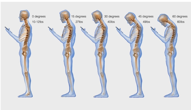 Chiropractic West Des Moines IA Text Neck X-Ray