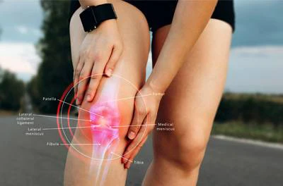 Chronic Pain West Des Moines IA Knee Pain Relief